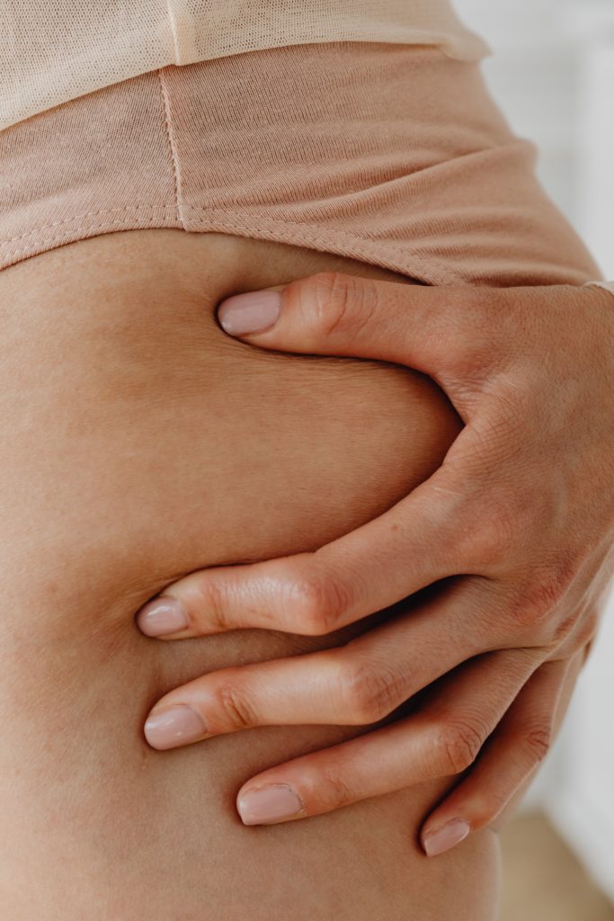 ¿Cómo eliminar la celulitis?