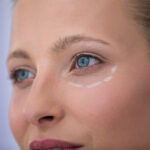 blefaroplastia-cirugia